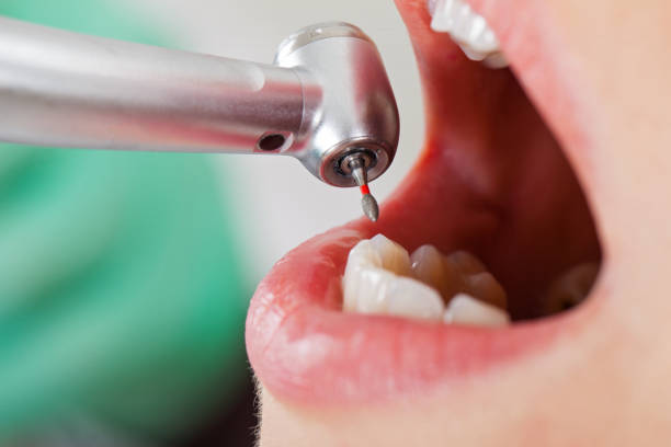 Best Emergency Dental Care for Broken or Chipped Teeth in Maysville, NC